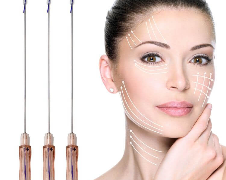 botox pdo threadlift 0 750x600