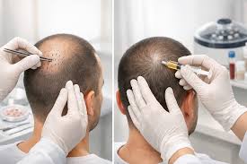 hair treatment
